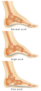 Flat Feet and High Arches