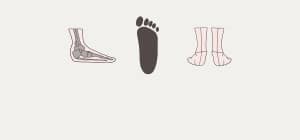 flat feet diagram
