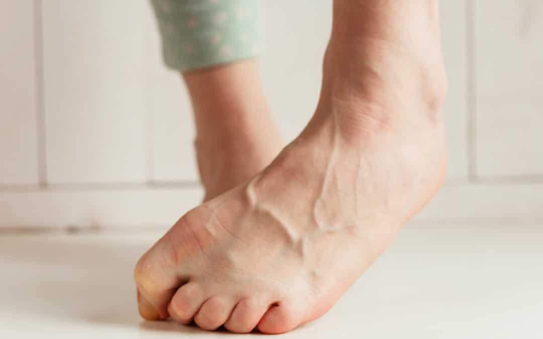 Common Foot Problems You Should NOT Ignore!